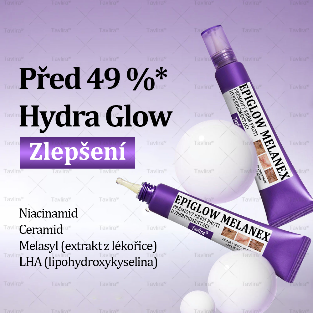 ✨Tavlira® EPIGLOW MelanEX prémiový krém proti hyperpigmentaci | ✅Schválené zdravotníckym oddelením České republiky
