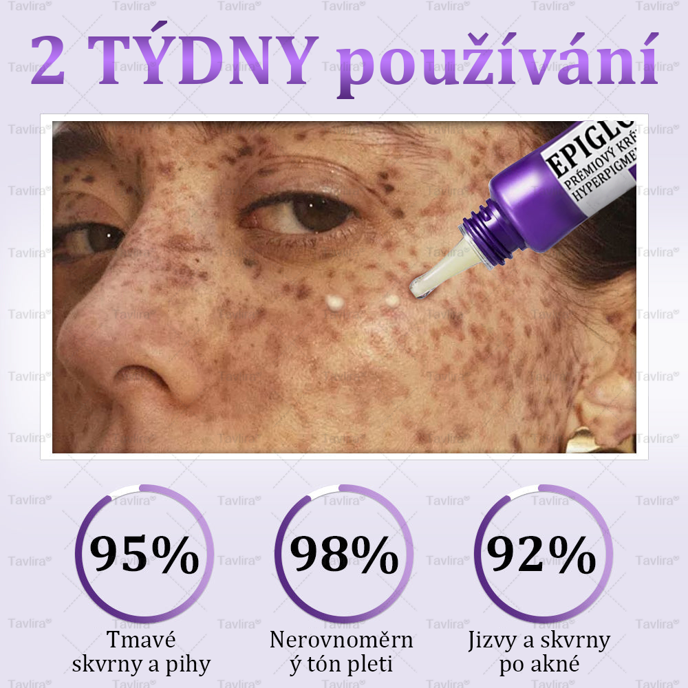 ✨Tavlira® EPIGLOW MelanEX prémiový krém proti hyperpigmentaci | ✅Schválené zdravotníckym oddelením České republiky