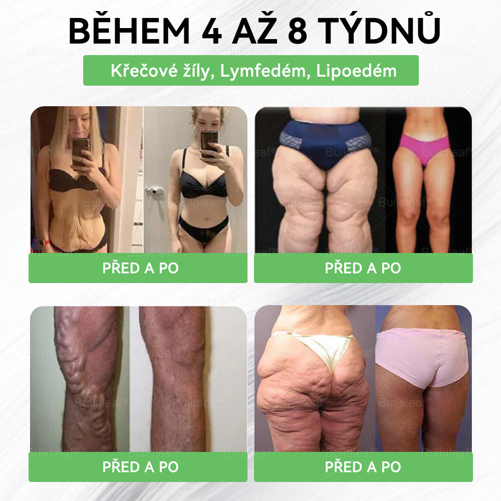 🎁💚🎁 Gratulujeme! Dnes patříte mezi šťastné zákaznice – získáváte až 50% slevu!Podpořte své tělo, rovnováhu a energii s BuildLeaf® – lehkost, vitalita a sebevědomí každý den! ✨