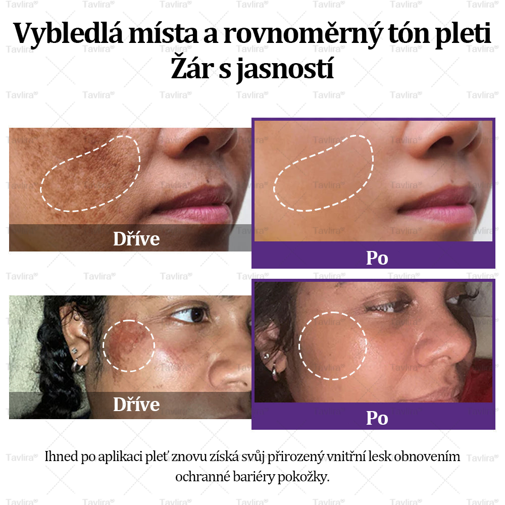 ✨Tavlira® EPIGLOW MelanEX prémiový krém proti hyperpigmentaci | ✅Schválené zdravotníckym oddelením České republiky