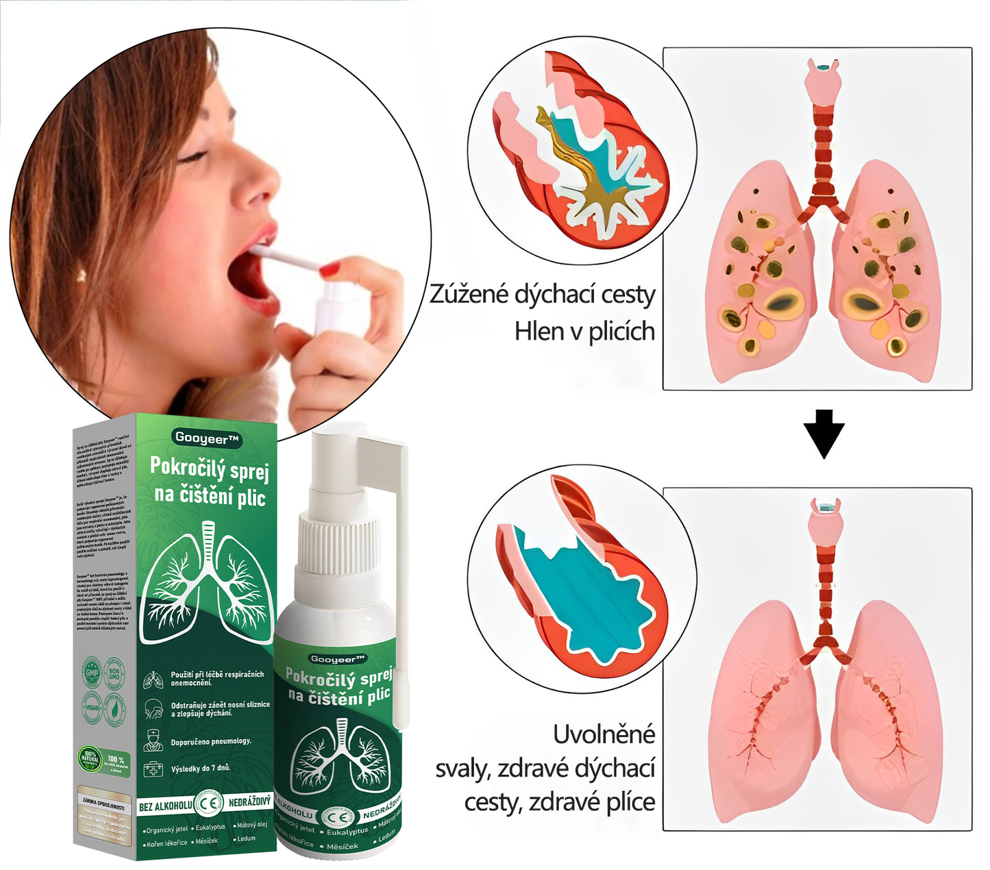 🍀🍀𝐆𝐨𝐨𝐲𝐞𝐞𝐫™ Pokročilý sprej na čištění plic -🧑⚕️ Podporuje zdraví plic, průdušek a dutin, napomáhá zdraví dýchacího systému a usnadňuje dýchání.
