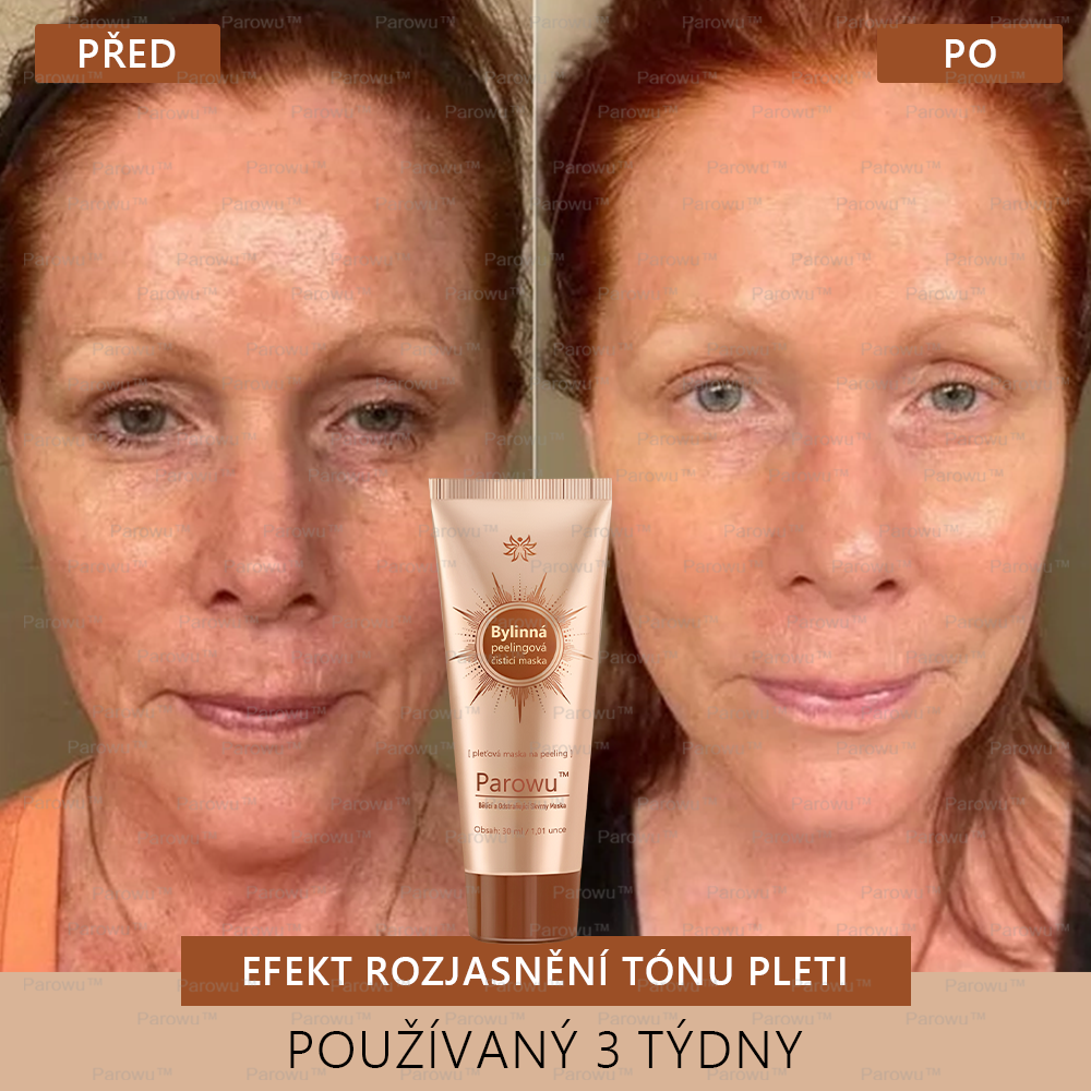 💟 Parowu™ Bělící a Odstraňující Skvrny Maska -🍀Přírodní složky trvale odstraňují pigmentové skvrny, stařecké skvrny, pihy a sluneční skvrny.