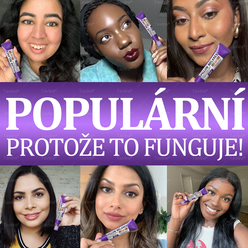 ✨Tavlira® EPIGLOW MelanEX prémiový krém proti hyperpigmentaci | ✅Schválené zdravotníckym oddelením České republiky