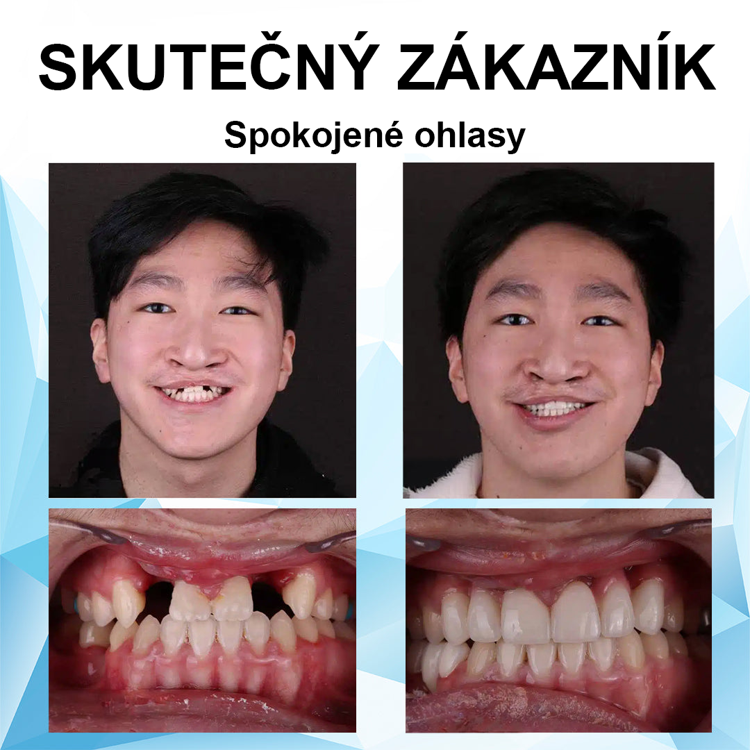 💎🦷💎JasnéZuby™ Sada silikonových vložek do protéz (⏰60% sleva na omezenou dobu, dnes zdarma doprava!⏰)