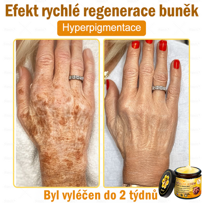 💛💛 Sinvie® Krém na obnovu pleti s včelím jedem ✅CE schváleno 👨‍⚕ Doporučeno dermatology - 50ml