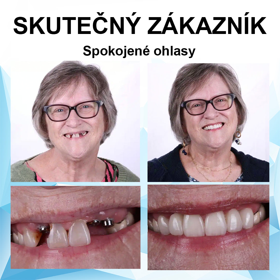 💎🦷💎🦷JasnéZuby™ Sada silikonových vložek do protéz (⏰60% sleva na omezenou dobu, dnes zdarma doprava!⏰)