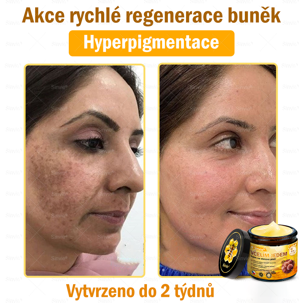 💛💛 Sinvie® Krém na obnovu pleti s včelím jedem ✅CE schváleno 👨‍⚕ Doporučeno dermatology - 50ml