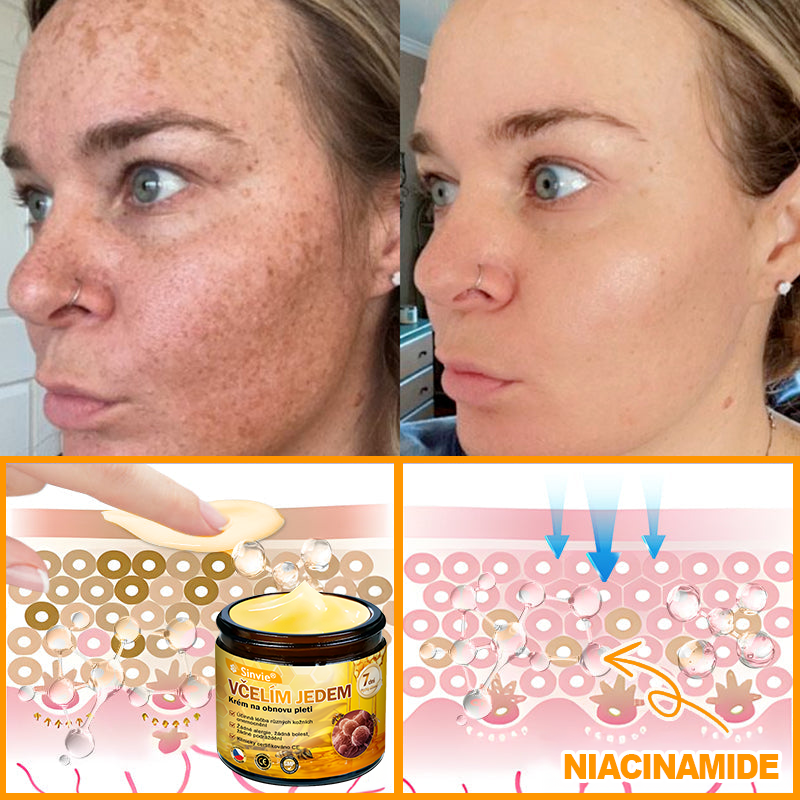 💛💛 Sinvie® Krém na obnovu pleti s včelím jedem ✅CE schváleno 👨‍⚕ Doporučeno dermatology - 50ml