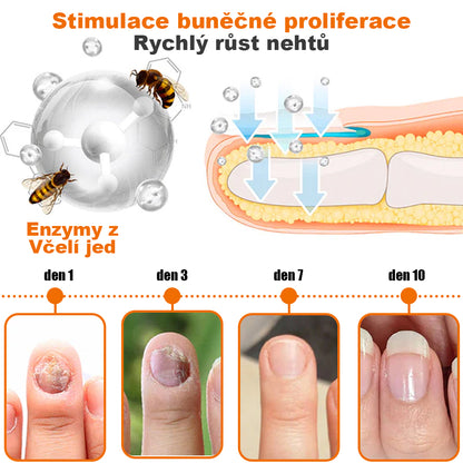 🐝🐝[✨Oficiální značkový obchod✨]NehtVital™ Včelí jed antibakteriální sérum na léčbu nehtů