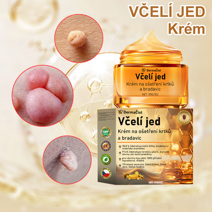 💎💎💎[✨Oficiální značkový obchod✨] DermaČist™ Včelí jed Krém na ošetření krtků a bradavic (👨‍⚕️ČDS DOPORUČUJE)