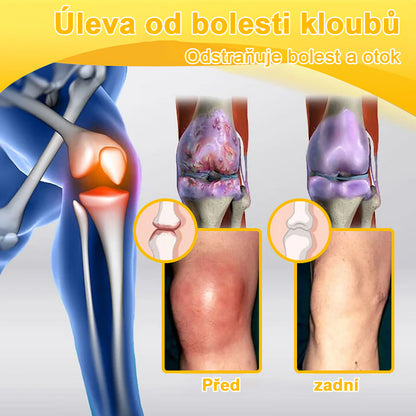 🐝🔥StawFlex® Krém na obnovu kloubů s včelím jedem (Novozélandský včelí extrakt - speciálně pro ortopedické problémy a bolest kloubů vyvinutý výzkumem a vývojem)