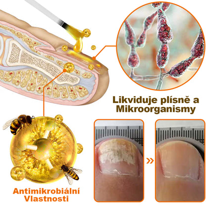 🐝🐝[✨Oficiální značkový obchod✨]NehtVital™ Včelí jed antibakteriální sérum na léčbu nehtů